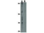 CCDC98 Antibody in Western Blot (WB)