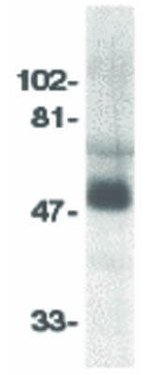 CCR8 Polyclonal Antibody