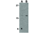 CDNF Antibody in Western Blot (WB)