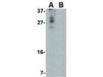 CDNF Antibody in Western Blot (WB)