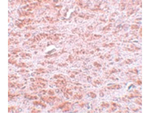 CDX2 Antibody in Immunohistochemistry (Paraffin) (IHC (P))
