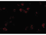 CD81 Polyclonal Antibody