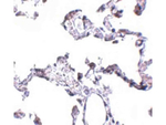 CD81 Antibody in Immunohistochemistry (Paraffin) (IHC (P))