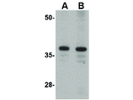 CDCA8 Antibody in Western Blot (WB)
