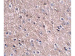 CDIP Antibody in Immunohistochemistry (Paraffin) (IHC (P))