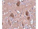 CDIP Antibody in Immunohistochemistry (Paraffin) (IHC (P))