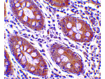 CDKN2A Antibody in Immunohistochemistry (Paraffin) (IHC (P))