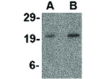 CDKN2A Antibody in Western Blot (WB)