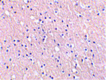 CIDE-A Antibody in Immunohistochemistry (Paraffin) (IHC (P))