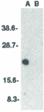 CIDE-A Antibody in Western Blot (WB)