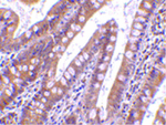 CIDE-B Antibody in Immunohistochemistry (Paraffin) (IHC (P))