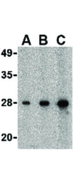 CIDE-B Antibody in Western Blot (WB)