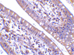 CIDE-B Antibody in Immunohistochemistry (Paraffin) (IHC (P))