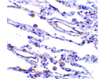 CIKS Antibody in Immunohistochemistry (Paraffin) (IHC (P))