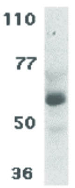 CIKS Antibody in Western Blot (WB)