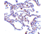 CIKS Antibody in Immunohistochemistry (Paraffin) (IHC (P))