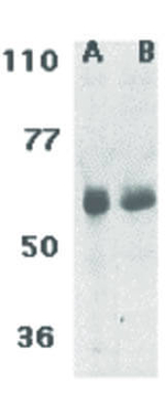 CIKS Antibody in Western Blot (WB)