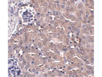 CIP75 Polyclonal Antibody