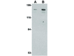CLIP170 Antibody in Western Blot (WB)