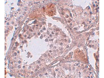CLPH Polyclonal Antibody