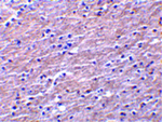 Clusterin Polyclonal Antibody