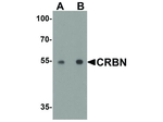 CRBN Polyclonal Antibody