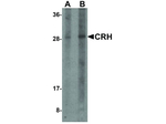 CRH Antibody in Western Blot (WB)