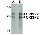 CRISP2 Antibody in Western Blot (WB)