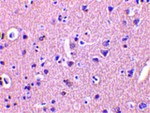 CRMP1 Antibody in Immunohistochemistry (Paraffin) (IHC (P))
