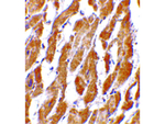 CRTH2 Polyclonal Antibody