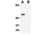 CRTH2 Antibody in Western Blot (WB)