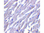 CRTH2 Antibody in Immunohistochemistry (Paraffin) (IHC (P))