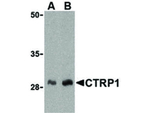 CTRP1 Antibody in Western Blot (WB)