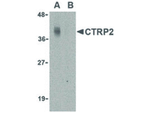 CTRP2 Polyclonal Antibody