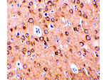 CTRP4 Antibody in Immunohistochemistry (Paraffin) (IHC (P))