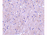 CTRP4 Antibody in Immunohistochemistry (Paraffin) (IHC (P))