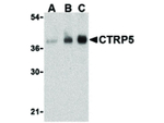 CTRP5 Antibody in Western Blot (WB)