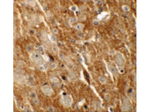 CTTNBL1 Antibody in Immunohistochemistry (Paraffin) (IHC (P))