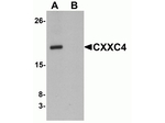 CXXC4 Antibody in Western Blot (WB)