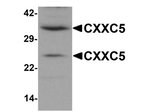 CXXC5 Antibody in Western Blot (WB)