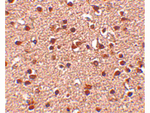 Dact2 Antibody in Immunohistochemistry (Paraffin) (IHC (P))