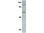 Dact3 Polyclonal Antibody
