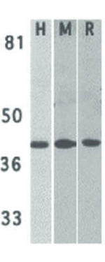 DAPK2 Antibody in Western Blot (WB)