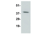DARC Antibody in Western Blot (WB)
