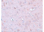DCLK1 Polyclonal Antibody