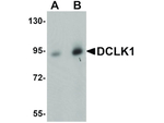 DCLK1 Antibody in Western Blot (WB)