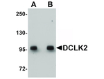 DCLK2 Antibody in Western Blot (WB)