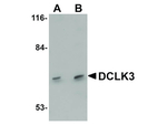 DCLK3 Antibody in Western Blot (WB)