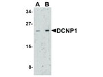 DCNP1 Antibody in Western Blot (WB)