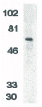 DcR1 Antibody in Western Blot (WB)